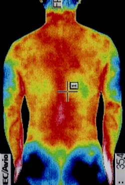 ストレスが原因の腰痛の原因｜筋力低下や背中の温度分布（治療後）