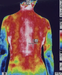 ストレートネック｜カラダの温度分布（治療前）