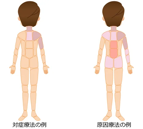 対症療法 原因療法の治療部位