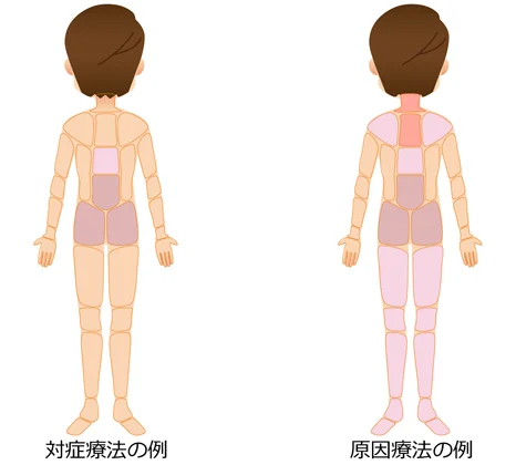 対症療法 原因療法の治療部位