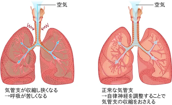 自己免疫疾患