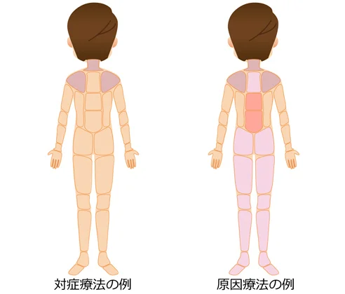 対症療法 原因療法の治療部位