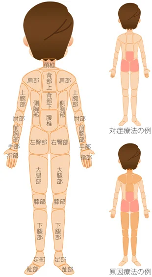 対症療法 原因療法の治療部位