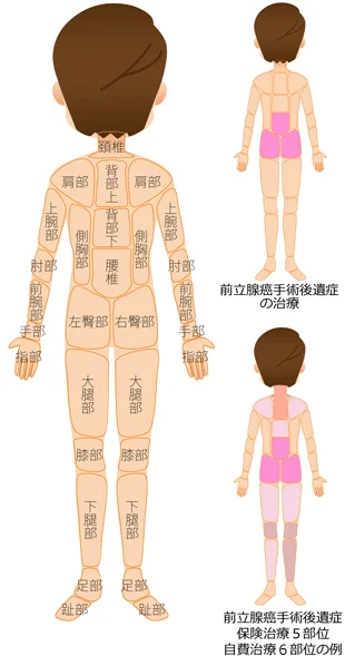 対処療法 原因療法の治療部位