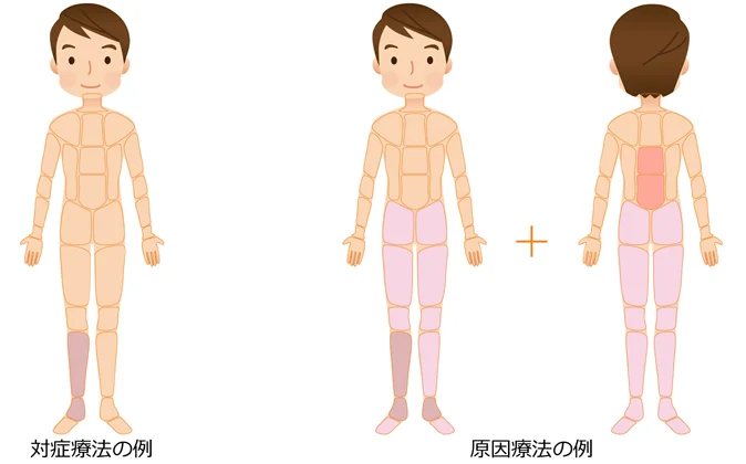 対症療法 原因療法の治療部位